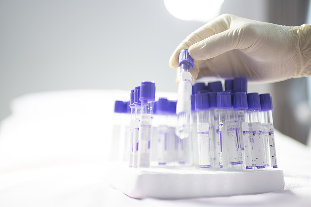 A close up image of a hand wearing a latex glove picking a vial out of a tray.